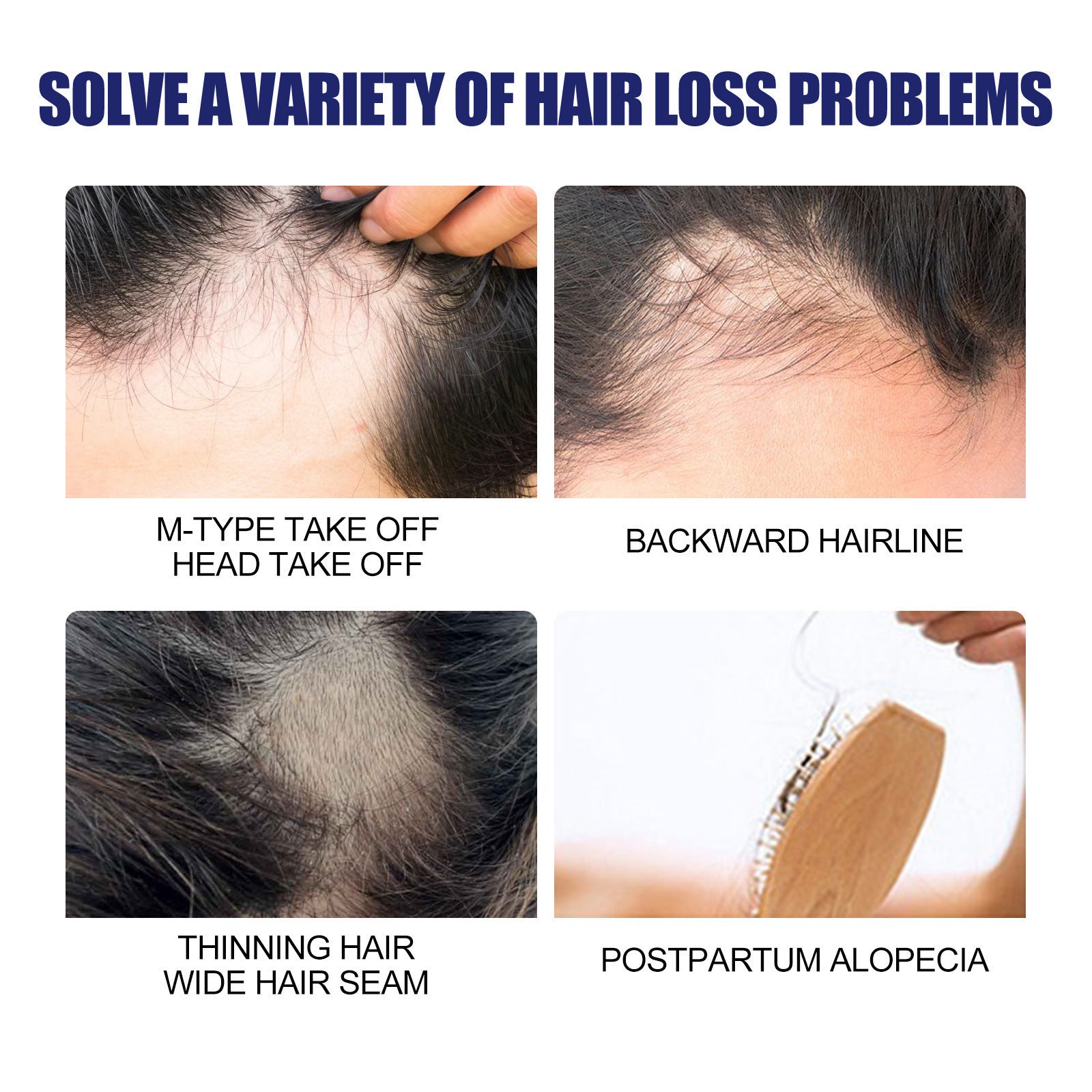 Men's Hair Thickening Foam